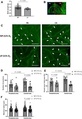 Amelioration of oxygen-induced retinopathy in neonatal mice with fetal growth restriction